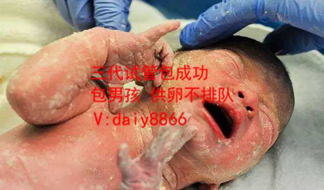 未婚试管_未婚哪里可以做试管吗_未婚的试管婴儿的权利_在香港单身做试管婴儿